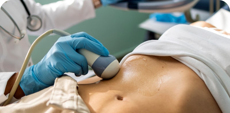 imagen de Ecografía