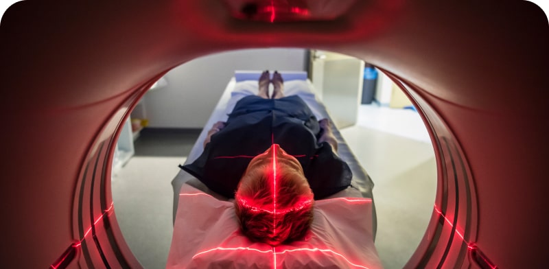 imagen de Resonancia magnética (RM)